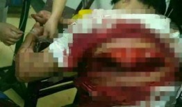 广西打架案件爆料最新,冲突升级，警方介入调查